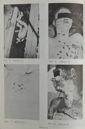 Seminar on Death Investigation, May 22 Through 25, 1972. Department of Chief Medical Examiner-Coroner, County of Los Angeles