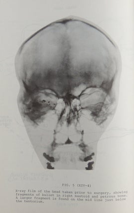 Seminar on Death Investigation, May 22 Through 25, 1972. Department of Chief Medical Examiner-Coroner, County of Los Angeles